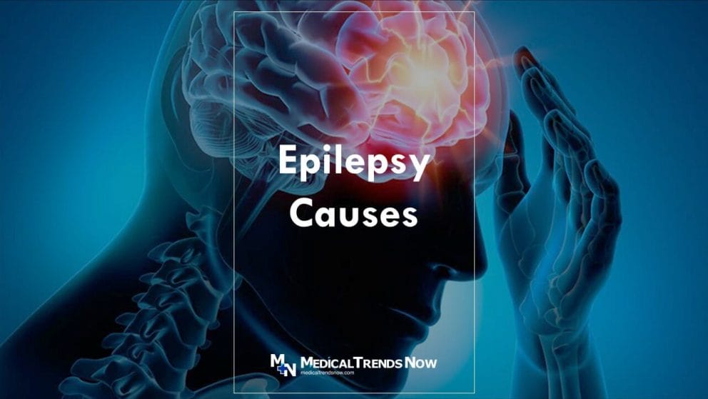 What are the signs of an epileptic seizure?