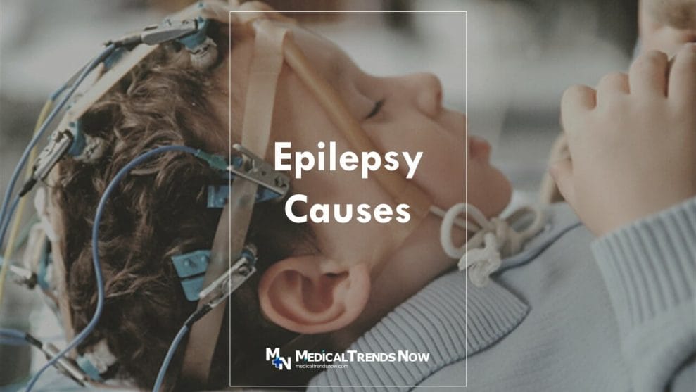 How do seizures usually start?
