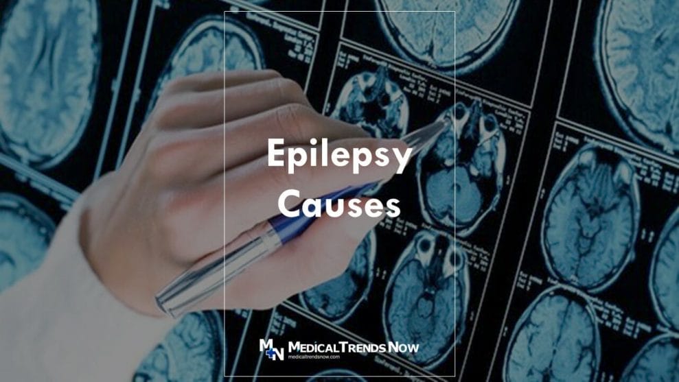 What is the symptoms of epilepsy?