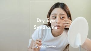 How can I treat dry eyes naturally?