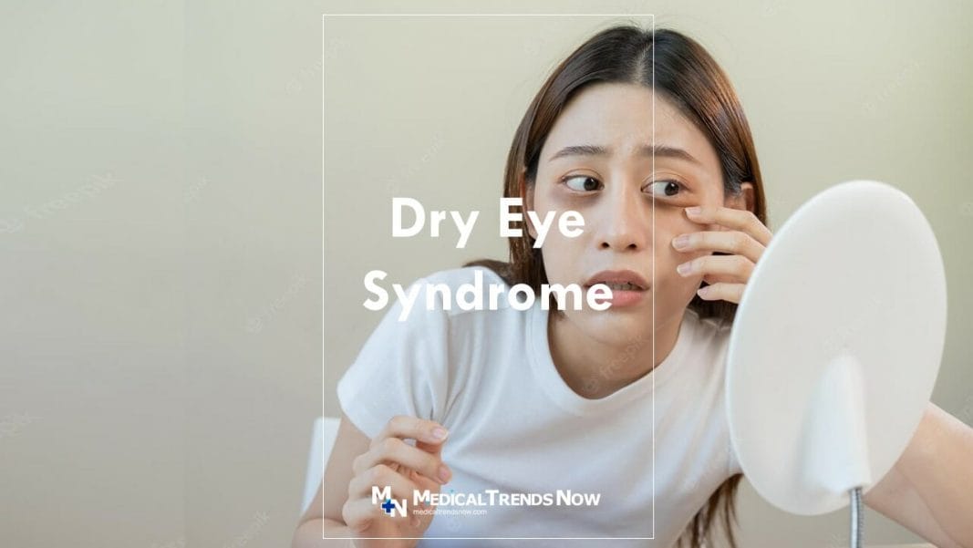 How can I treat dry eyes naturally?