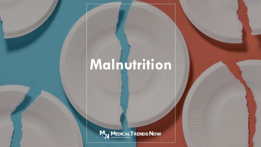 Malnutrition meaning definition