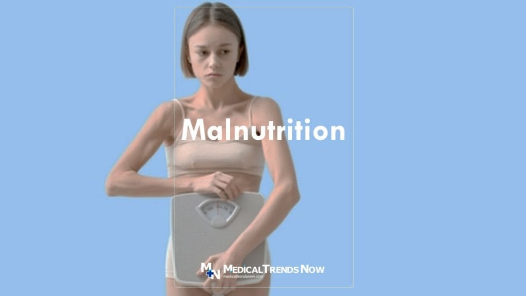 malnutrition symptoms