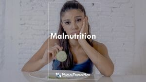 malnutrition criteria aspen