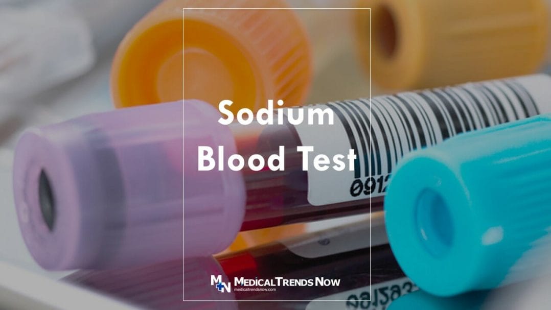 Sodium in Blood Test 