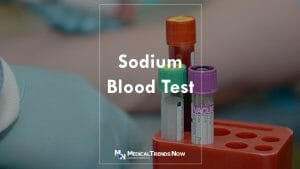 Sodium (Na) in Blood Test
