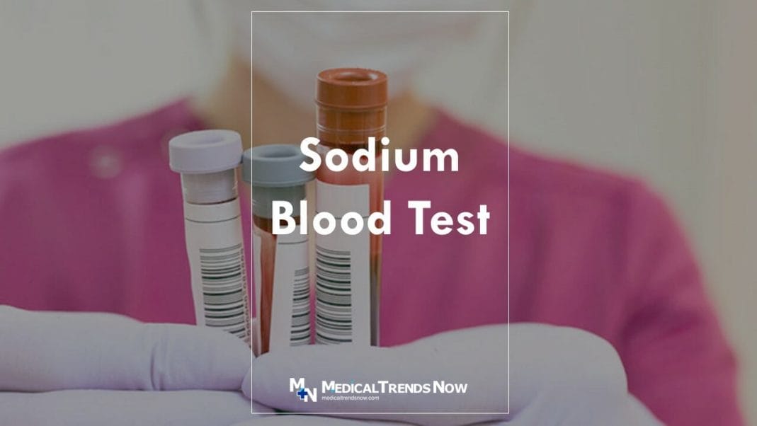 Blood Sodium Level Test: Purpose, Procedure, and Results