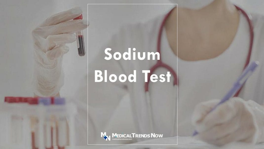 Sodium Blood normal range