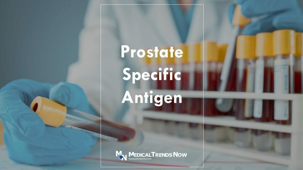 Prostate-Specific Antigen Testing Is Important For Filipino Men ...