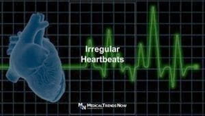 Irregular heartbeats symptom of anemia