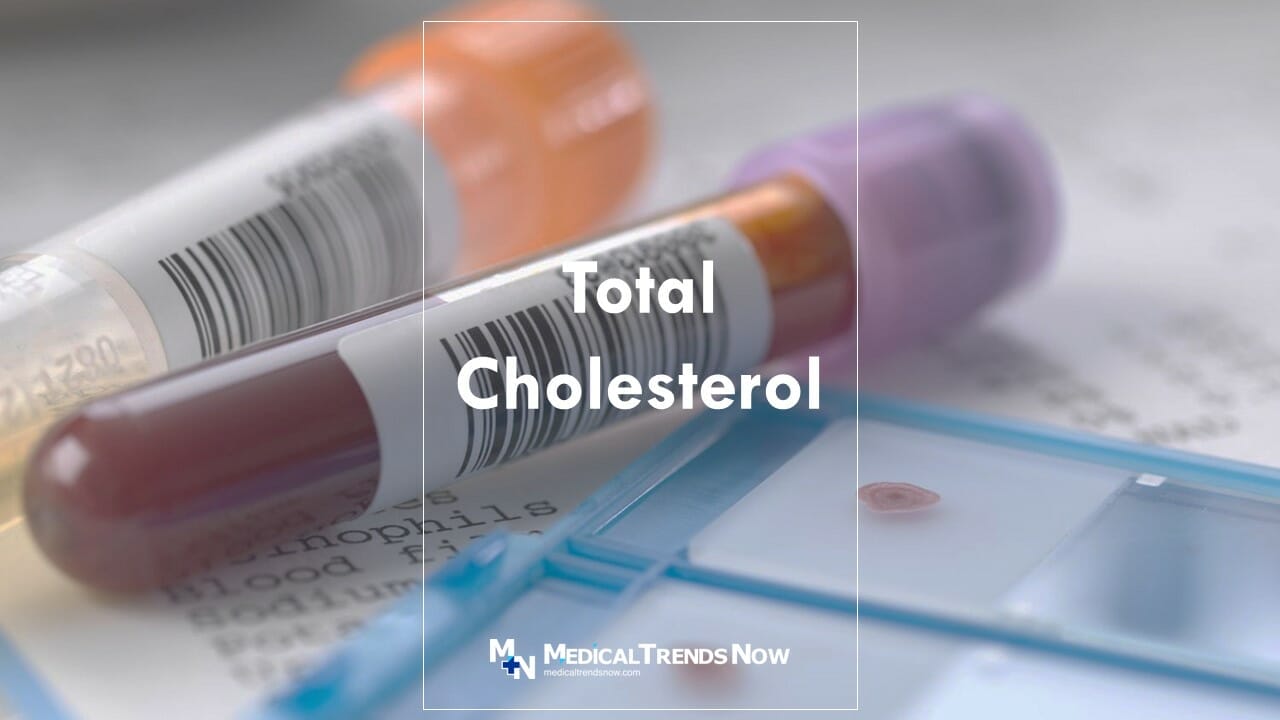 A blood testing for Cholesterol in the Philippines