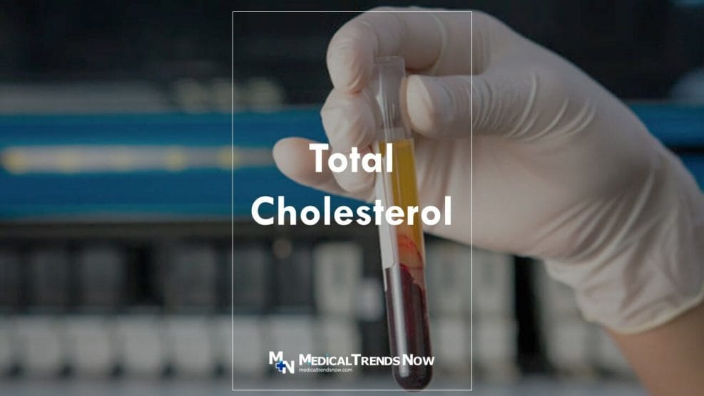 A blood test for Cholesterol in the Philippines