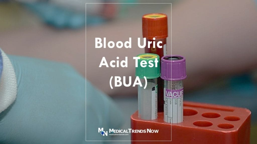 what is uric acid test