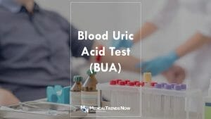 how much is blood uric acid test in the Philippines