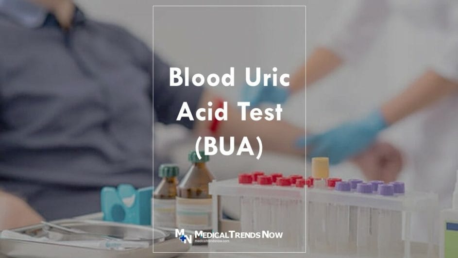 how much is blood uric acid test in the Philippines