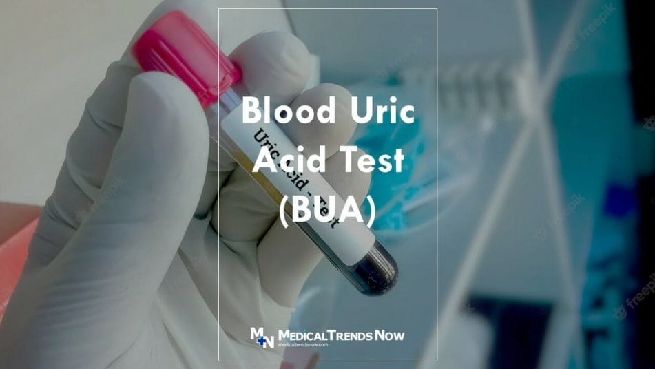 price of uric acid blood test in the Philippines