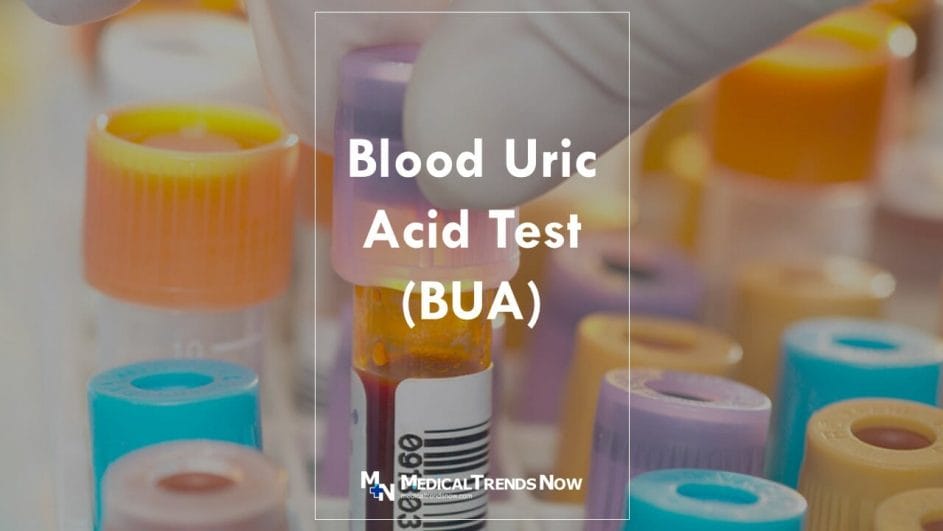 uric acid blood test in the Philippines