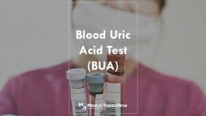 uric acid test result meaning