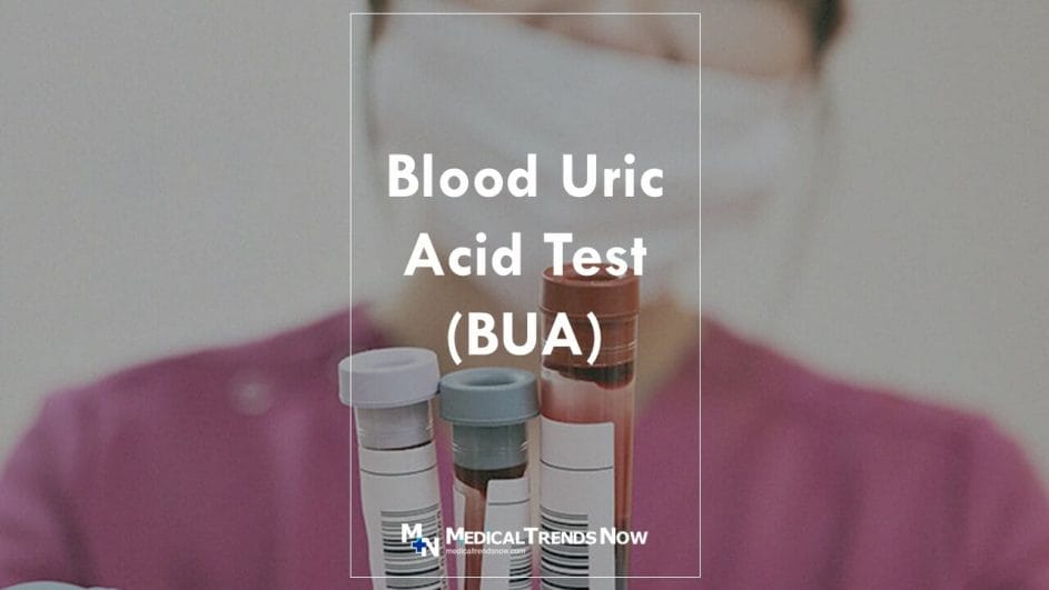 uric acid test result meaning