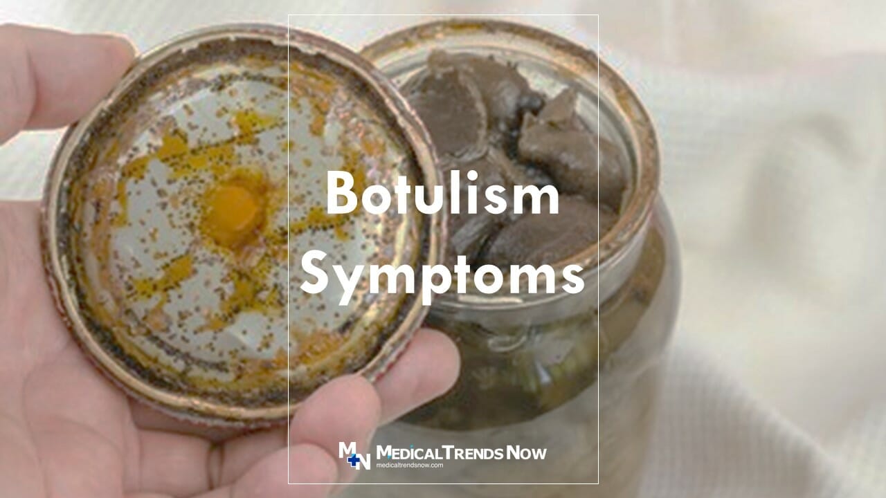 Clinical Guidelines for Diagnosis and Treatment of Botulism