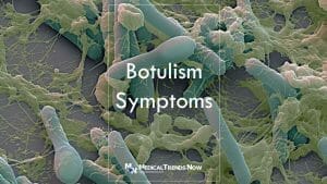 How long until botulism is fatal?