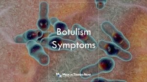How long does it take to show signs of botulism?