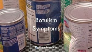 Can you survive botulism without treatment?