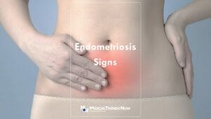 endometriosis hyperplasia