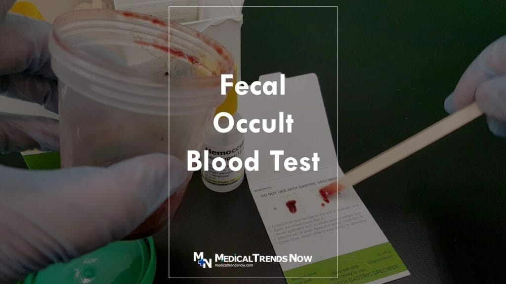 Fecal Occult Blood Test: Ultimate Guide For Filipinos – Medical Trends Now