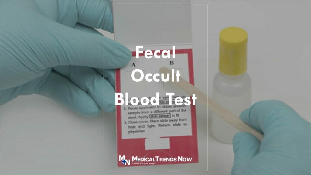 Fecal Occult Blood Test: Ultimate Guide For Filipinos – Medical Trends Now