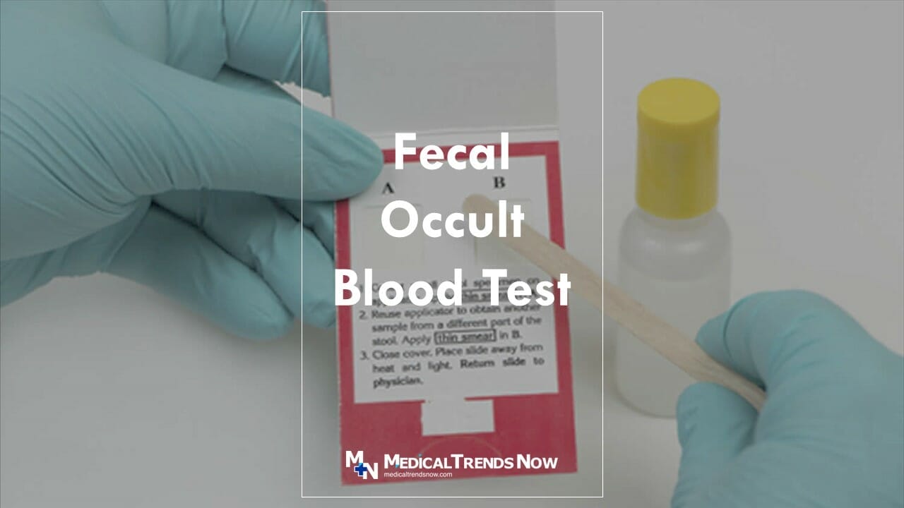 Fecal Occult Blood Test: Ultimate Guide For Filipinos – Medical Trends Now