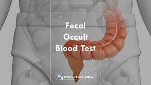 When should you test stool for occult blood?