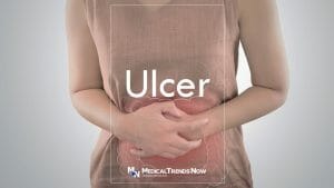 what is the fastest way to cure a stomach ulcer?
