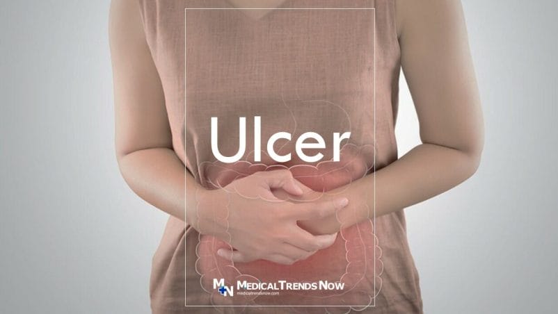 what is the fastest way to cure a stomach ulcer?