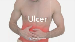 What Causes Ulcers - Stomach Ulcer Symptoms