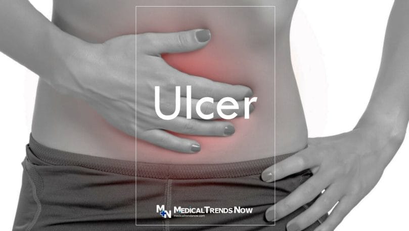 Stomach Ulcer: Causes, Symptoms, and Diagnosis 
