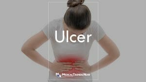 Peptic Ulcer Disease: Treatment, Symptoms, Causes, Prevention