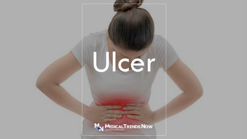 Peptic Ulcer Disease: Treatment, Symptoms, Causes, Prevention