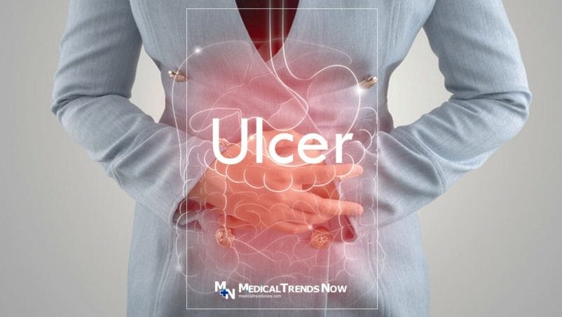 Stomach ulcer (Gastric ulcer) 