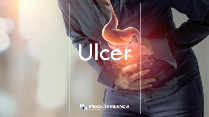 The Best Natural and Home Remedies for Ulcers 