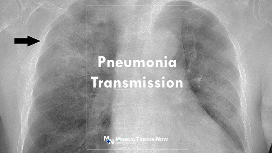 Pneumonia: Transmission & Prevention 