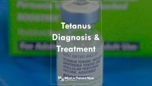 Is amoxicillin can cure tetanus?