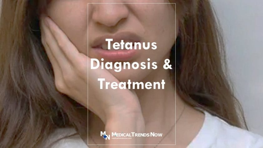 How long does it take for tetanus symptoms to show?