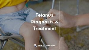Tetanus - Diagnosis and treatment