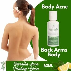Greenika Acne Lotion For Bacne Arms Back Body Acne Scar Spot Remover Lotion