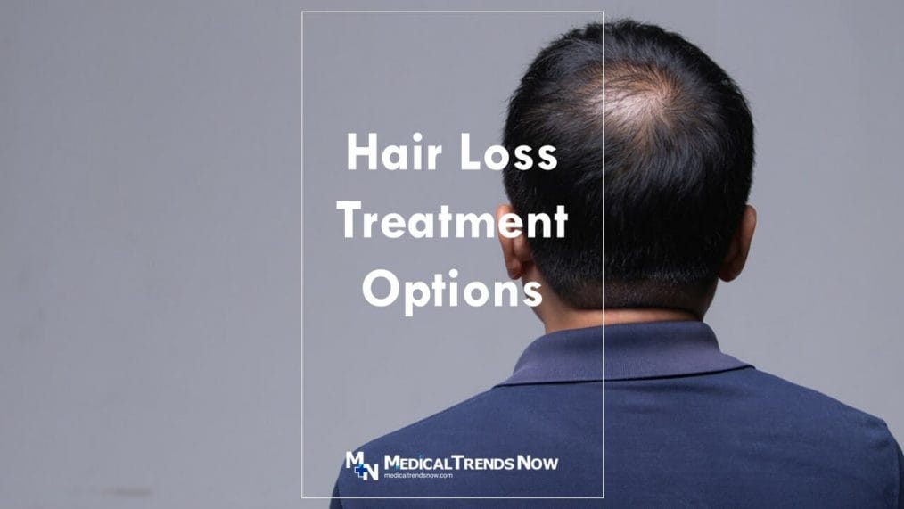 Treatments for Hair Loss in the Philippines