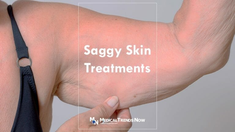 Treatments For Saggy Skin In The Philippines Medical Trends Now