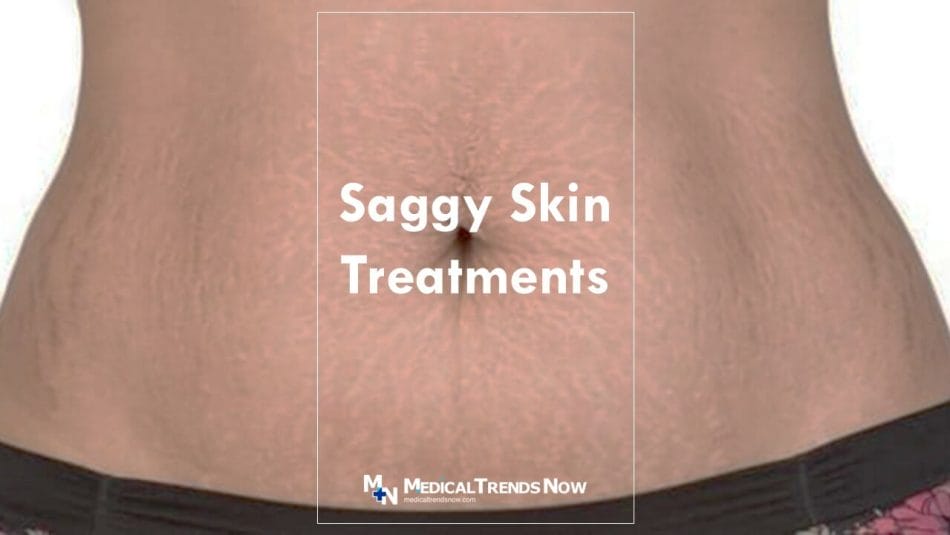 Sagging & Loose Skin Treatment Philippines