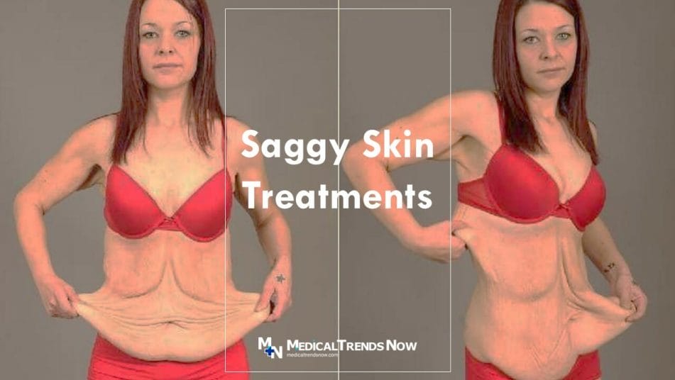 What are the Treatment Options for Sagging Skin?