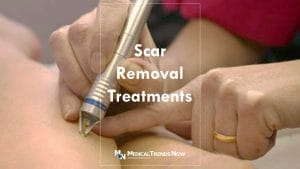 How to Get Rid of Old Scars: Top 10 Remedies